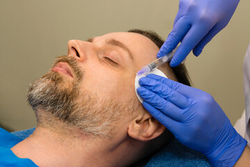 Mesotherapy rejuvenation injection for man