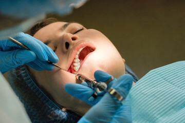 Anesthesia with lidocaine using carpool syringe