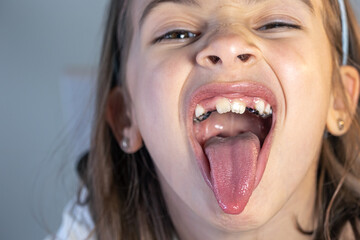 Child during orthodontist visit and oral cavity check-up.