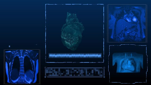 MRI x-ray images of the heart in different projections computer animation