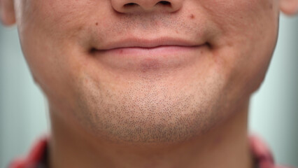 Obraz premium Close-up of a man's lips. Problem skin. Selective focus. Fragment of a person's face. The male