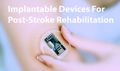Implantable Devices For Post-Stroke Rehabilitation Implantable Electronic Medical Devices Concept
