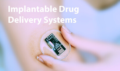 Implantable Drug Delivery Systems Implantable Electronic Medical Devices Concept