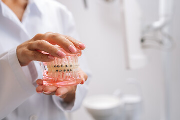 Closeup cropped shot of unrecognizable female orthodontist doctor in white coat holding human jaws layout model with metal dental braces in dentistry clinic. Concept of stomatology, orthodontics