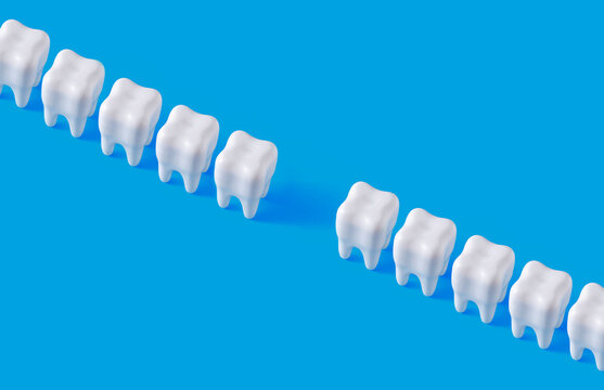 Row of white teeth and gap between them. Concept of absence, loss of tooth or something else
