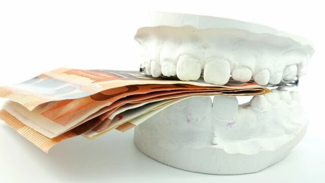 Closeup kid orthodontic dental impression chalk model biting euro money rotating on white background