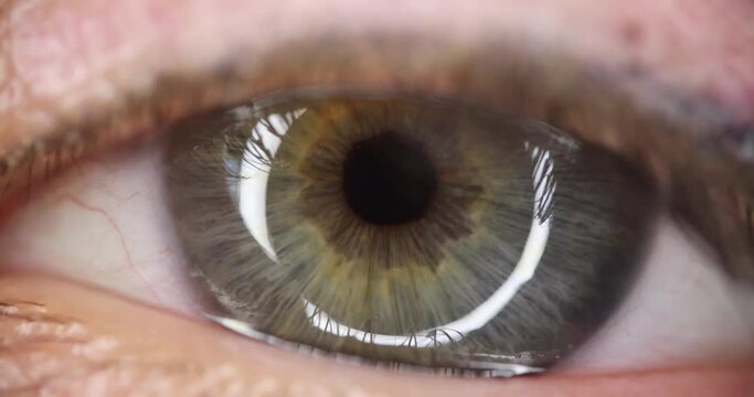 Human eye with a gray-green pupil. Laser vision correction concept