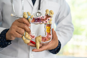 Intestine, appendix and digestive system, doctor holding anatomy model for study diagnosis and...