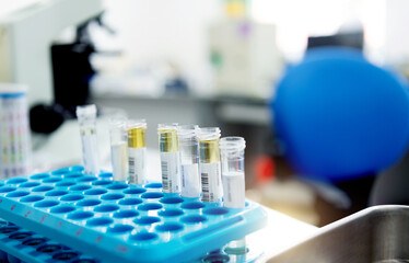 Rack with group of tubes and laboratory microscope