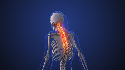 Neck pain or neck dysfunction