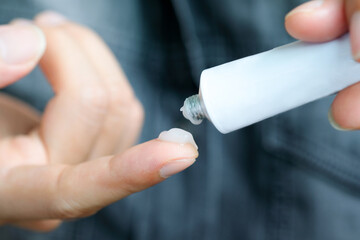 The man's hand, she uses steroids Apply External type