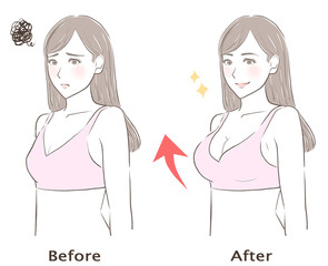 バストアップに成功した女性