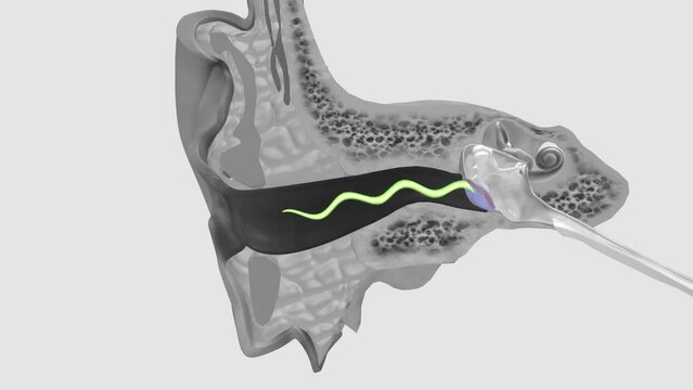 Tympanic Membrane External auditory canal