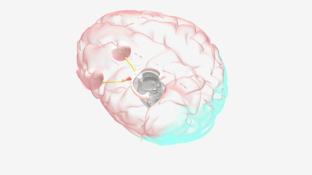 Optic Neuritis Impaired Vision