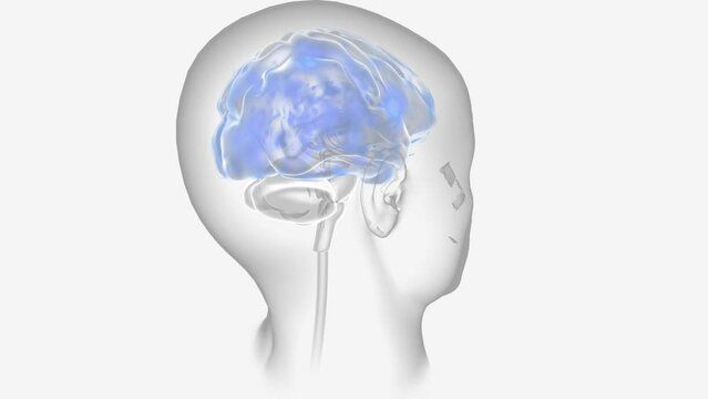 Epilepsy Seizure Activity in Neurons