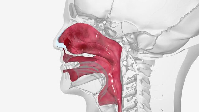 Epistaxis (also called a nosebleed) refers to a minor bleeding from the blood vessels of the nose