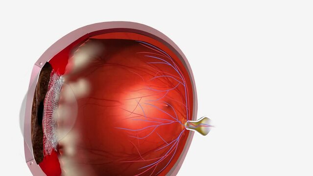 The pars plana is a narrow section of the ciliary body, inflammation of which is known as pars planitis
