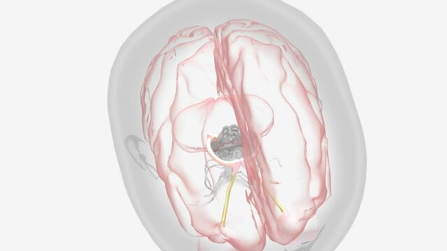 Optic Neuritis Impaired Vision