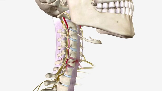 Subaxial Cervical Vertebral Body Fractures are a subset of cervical spine injuries that consist of compression fractures, burst fractures