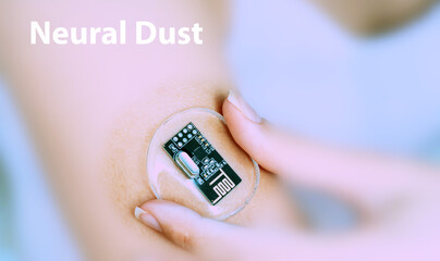 Neural Dust Implantable Electronic Medical Devices Concept