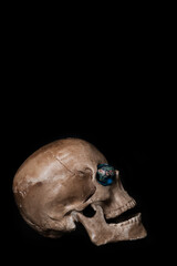 Human skull with a glass globe in its eye socket