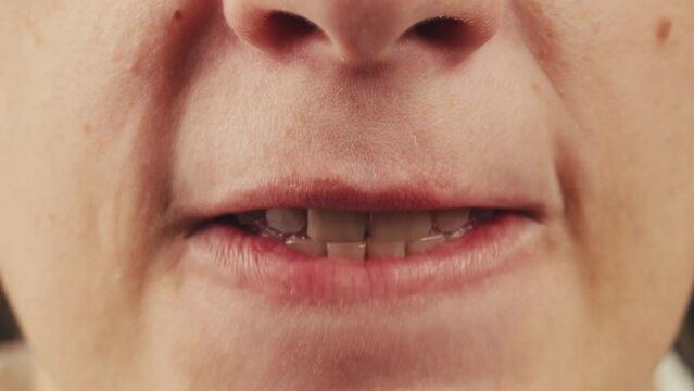 Woman bites her lips. Nervous tic. Obsessive-compulsive disorders. Patient of a psychiatric clinic biting lips, scratch face, biting nails, eye twitching. Close up, macro. 