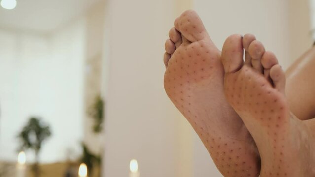 Women's legs after standing on boards with nails, copy space. Sadhu board. Barefoot woman who was standing on a yoga nail board