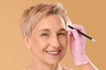 Obraz premium Beautician marking forehead of mature woman for filler injection on beige background, closeup