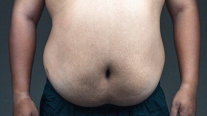 Fat mature man check out body overweight abdomen his belly for grey or obesity background. Weight...