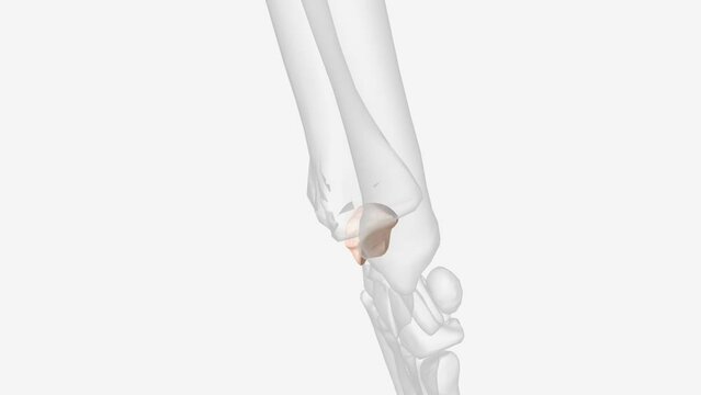 The scaphoid bone is one of the carpal bones on the thumb side of the wrist, just above the radius