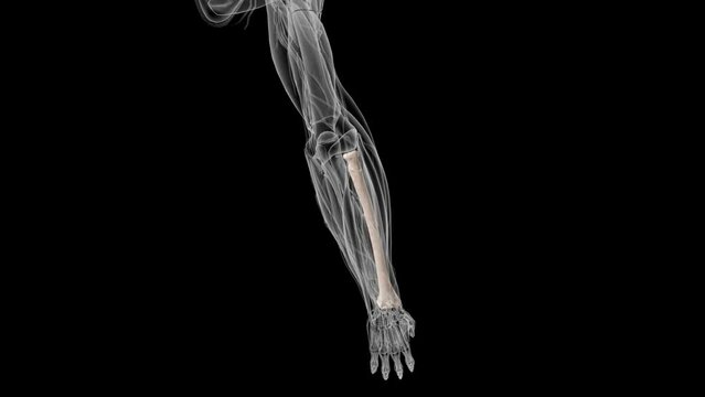 The radius or radial bone is one of the two large bones of the forearm, the other being the ulna
