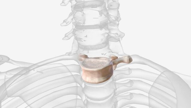 The first thoracic vertebra (T-1) has a whole costal facet superiorly