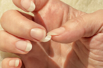 Broken nail. Natural long nails without polish. Cracked, chipped nail. Female fingernails polish-free.