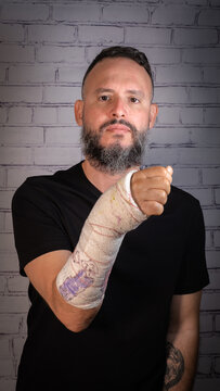 Young man with beard and without glasses, wearing a black T-shirt. Broken arm with plaster painted with children's drawings. Tenerife, Canary Islands, Spain.