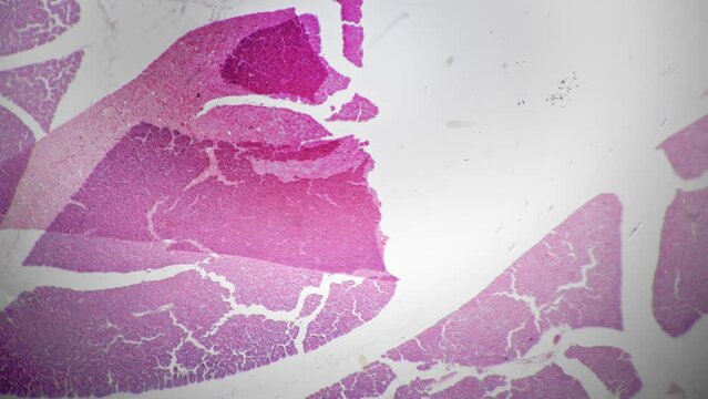 Macro scientific slide of human pancreas tissue magnified under microscope 40 on bright field background. Sample of digestive system organ located in the abdomen. Research of people anatomy concept