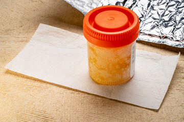 frozen urine sample ready to be mailed to a lab in a thermo bag, home health testing concept