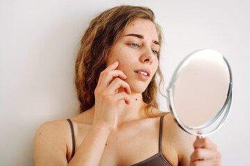 Skin problem. Curly woman touches red inflammations on her face while looking in the mirror in a...