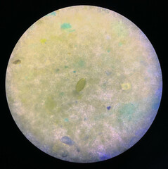 trichuris trichiura egg human parasite in stool or faeces examination test find microscope