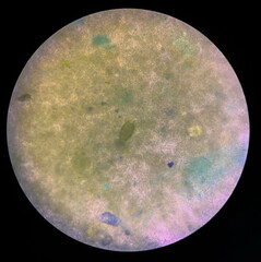 trichuris trichiura egg human parasite in stool or faeces examination test find microscope
