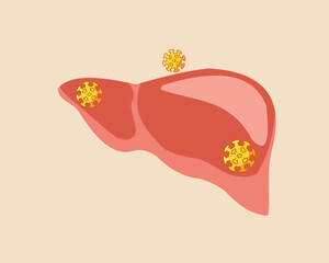 Human liver with symbols of hepatitis virus World Hepatitis awareness Day.