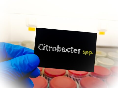 Citrobacter spp. bacteria. medical and healthcare conceptual image.