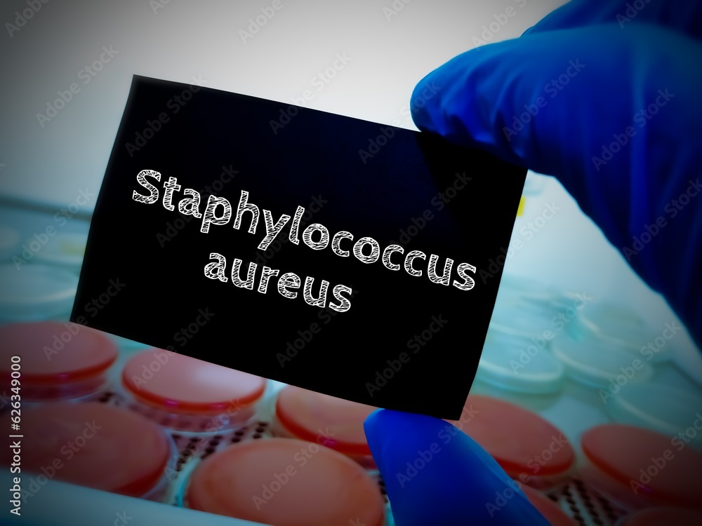 Wall mural Streptococcus aureas bacteria. medical and healthcare conceptual image.