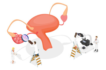 3D Isometric Flat  Conceptual Illustration of Polycystic Ovary Syndrome