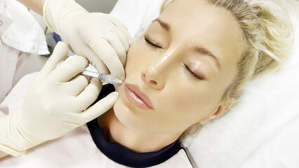 Obraz na płótnie Canvas Hyaluronic acid injections for specific areas.Lip augmentation with hyaluronic acid fillers,using flexible hyaluronic acid fillers