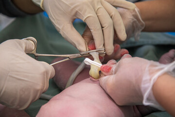 doctor performing procedure on umbilical cord in newborn