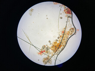 Notoedres cati under the microscope. Notoedric mange, also referred to as Feline scabies, is a...