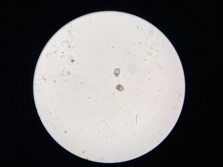 Notoedres cati under the microscope. Notoedric mange, also referred to as Feline scabies, is a highly contagious skin infestation caused by an ectoparasitic and skin burrowing mite Notoedres cati.