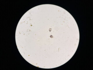 Notoedres cati under the microscope. Notoedric mange, also referred to as Feline scabies, is a highly contagious skin infestation caused by an ectoparasitic and skin burrowing mite Notoedres cati.