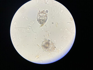 Notoedres cati under the microscope. Notoedric mange, also referred to as Feline scabies, is a...