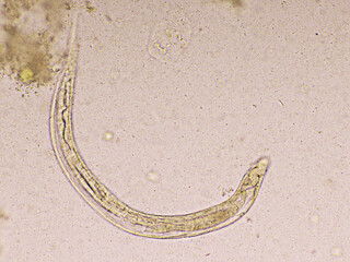 Strongyloides stercoralis or threadworm in human stool, analyze by microscope, original...